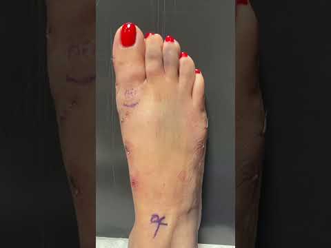 360 Foot Makeover