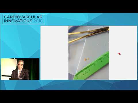 CVI2018 Session: My Worst Complication (Mt. Sopris Room, July 26, 10:30 am)