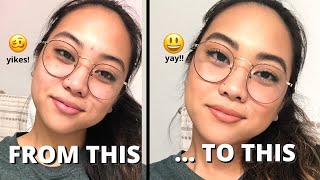 HOW TO COVER SCABBED ACNE SPOTS (EW!) WITH MAKEUP