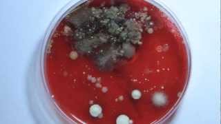 Bacteria Growth Time Lapse