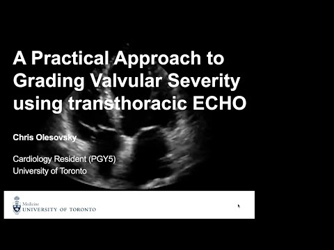 A practical approach to grading valvular severity using transthoracic echo.