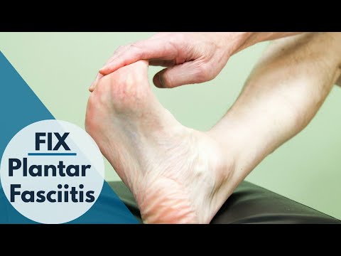 How to Fix Plantar Fasciitis in Seconds (This Works)