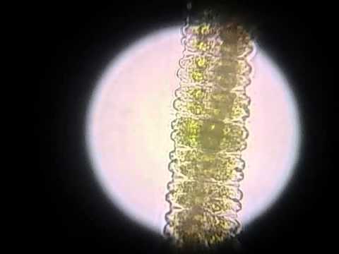 pond scum under 400x and 1000x