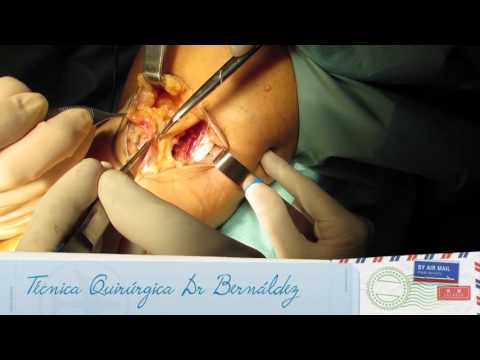 Posterior knee tumor ultrasound knee