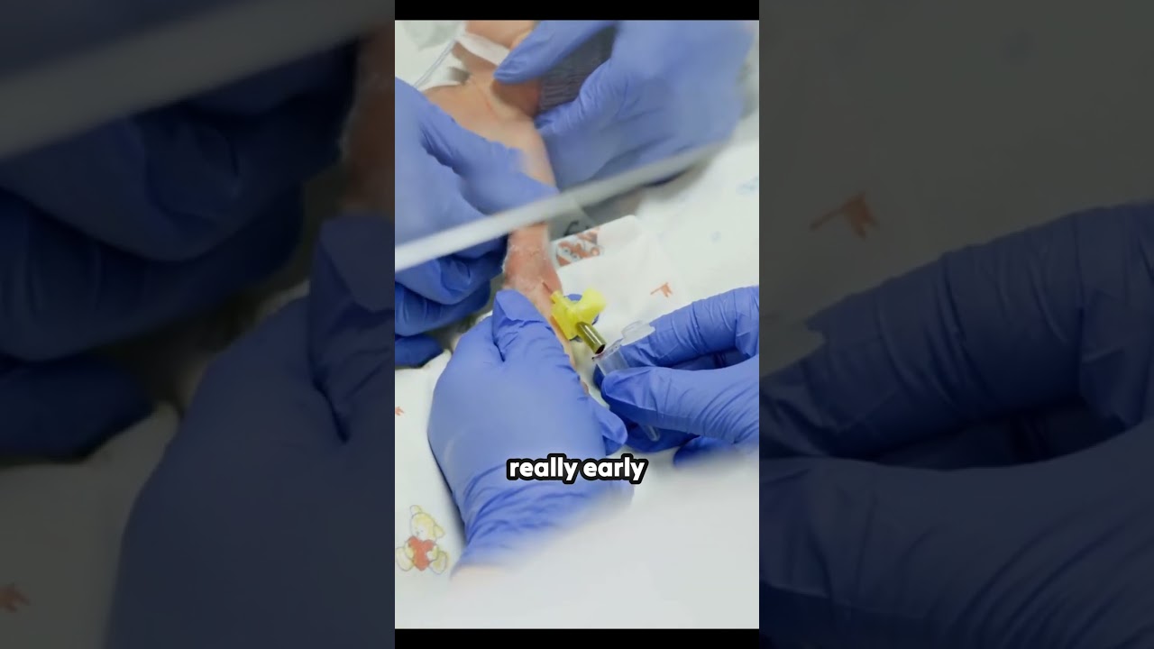 The 'Vanishing Bridge' Paradox of Evolution