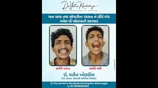 Download lagu mouth opening surgery #doctor #dentalprosthesis #dentalclinic #slipdiscsurgery #dentist #haircare mp3