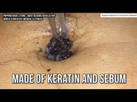 download lagu mp3 mp4 Dirty Belly Button, download lagu Dirty Belly Button gratis, unduh video klip Dirty Belly Button