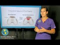 Can chondromalacia patella be treated with Prolotherapy? FAQ about knee degeneration and arthritis