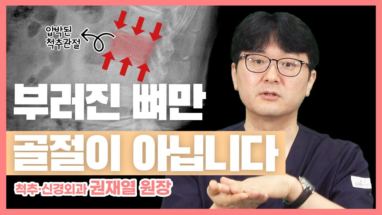 뼈가 부러진 것도 아닌데 골절이라고요? 압박골절 Part 1 (#성남 #성모윌병원) 썸네일 이미지