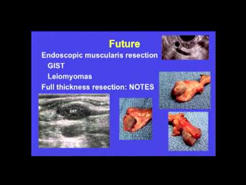 Lecture: Therapeutic Endoscopy and the Future of Surgical Practice