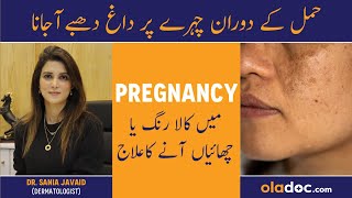 Melasma During Pregnancy - Hamal Men Chaiyon Ka Ilaj - How To Prevent Pregnancy Melasma - Dark Spots