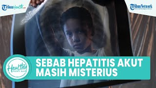 Penyebab Hepatitis Akut Intai Anak Masih Misterius, Beda dengan sebelumnya Bisa Picu Gagal Hati