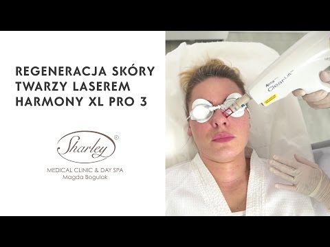 Leczenie przebarwień i porowatości skóry laserem Harmony HL PRO