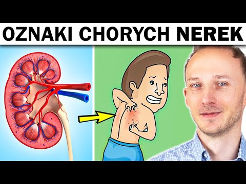Objawy, że nerki wysiadają - jeśli je masz, zrób TO badanie moczu