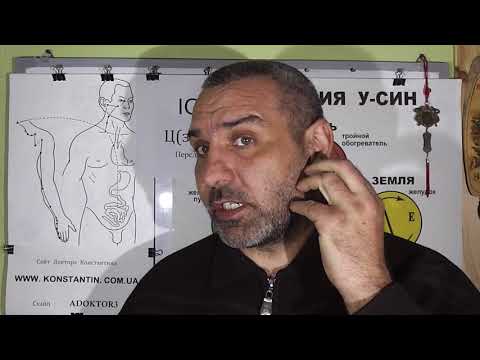 Сустав человека схема Операция секвестрированной грыжи в шейном отделе