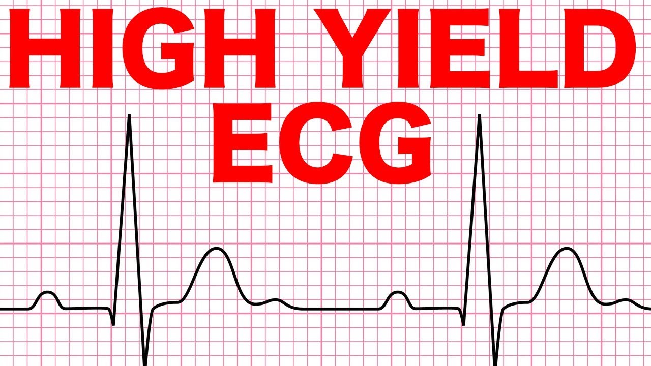 Electrocardiograms (ECG) Made Easy!