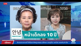 โรงพยาบาลนานะ ย้อนวัย 10 ปี