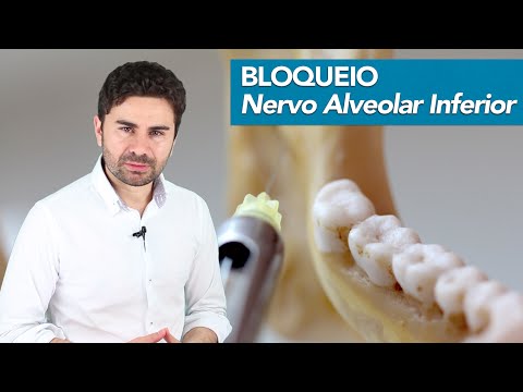 Vídeo Aula – Bloqueio do Nervo Alveolar Inferior