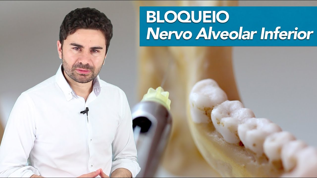 Passo-a-Passo do Bloqueio do Nervo Alveolar Inferior | Prof Fernando Giovanella