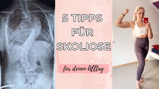 5 Tipps für Skoliose // Hilfe bei Skoliose // Übungen und Mindset mit 