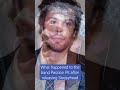 What happened to the band Passion Pit after releasing Sleepyhead #music #indie #passionpit #shorts