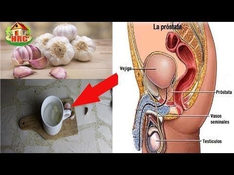 Der Einfluss von Alkohol Prostatitis Prostata Testosteron Hormon
