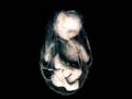 Amnesia - Sanguis et Cinis 