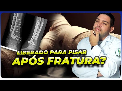 PISAR NO CHÃO após FRATURA DE TÍBIA, FÊMUR, TORNOZELO, JOELHO e sente dor?