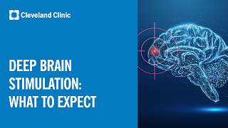 Deep Brain Stimulation: What To Expect
