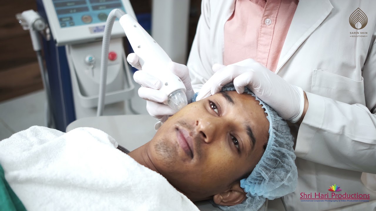 testimonial video shoot for doctors - acne scars treatment in delhi