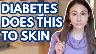 WHAT DIABETES DOES TO YOUR SKIN // DERMATOLOGIST @DrDrayzday