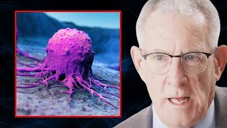Cancer Lives on Glucose AND Something Else Dr Thomas Seyfried Mp4 3GP & Mp3