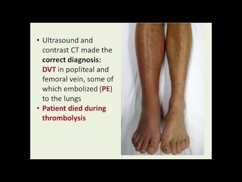VASCULAR EXAMINATION OF THE LOWER EXTREMITIES