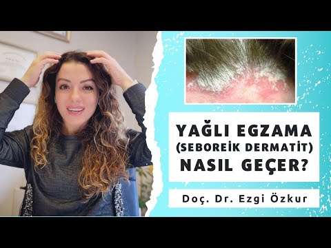 Yağlı Egzama Nasıl Geçer? Seboreik Dermatit Tedavisi - Dr. Ezgi Özkur