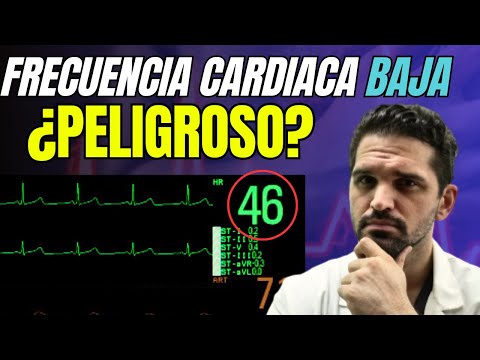 ¿Te Ocurre? BRADICARDIA y Latidos lentos. Esto debes saber✅