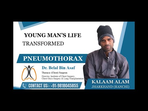 VATS Surgery for Collapsed Lung (Pneumothorax) | Patient Story & Results