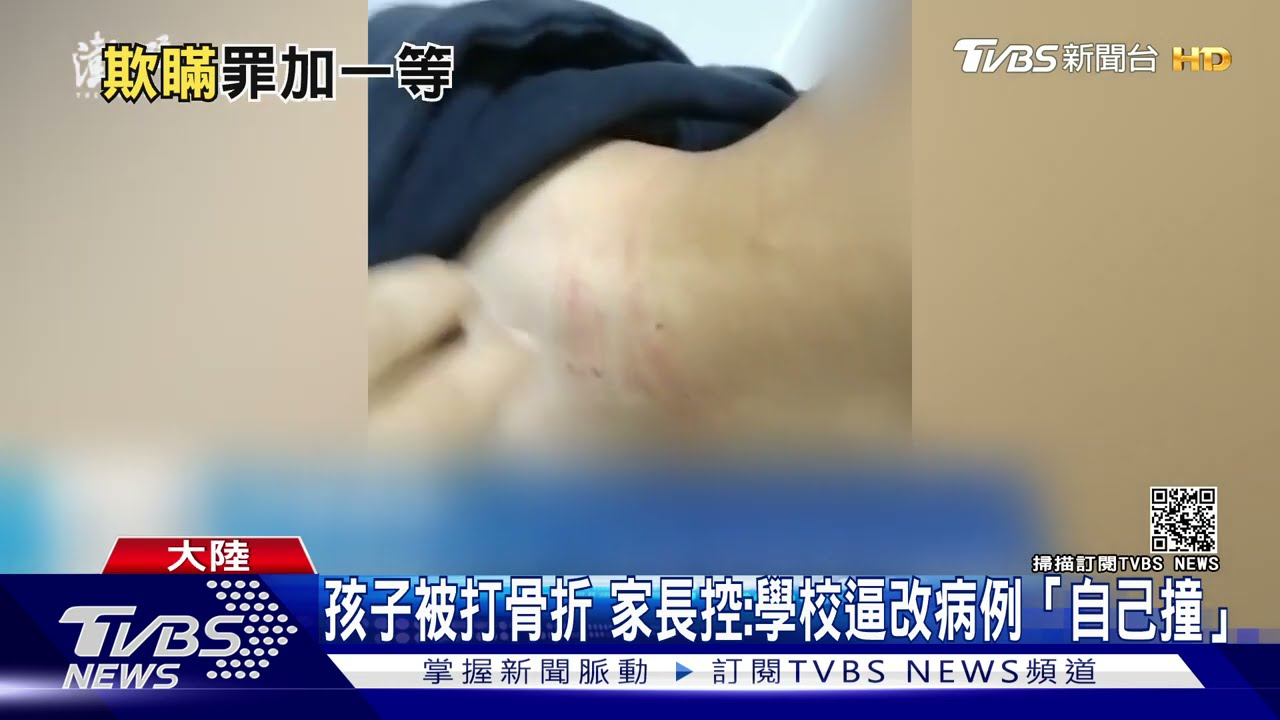 孩子被打骨折送醫陸家長控訴 學校逼改病例「自己撞」