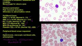 Anaemia in a young woman - Haematology case studies