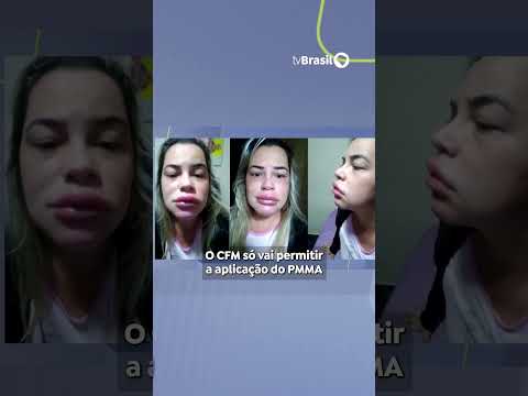 Conselho Federal de Medicina proíbe uso de PMMA para fins estéticos ou reparadores