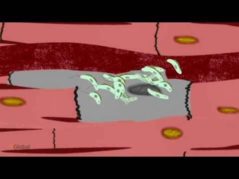 Chagas Disease: Life cycle of the parasite (human stages)