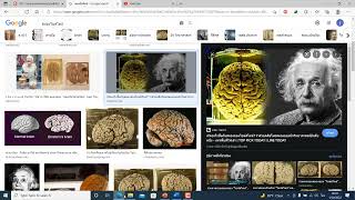 ระบบประสาทส่วนกลาง (สมอง)