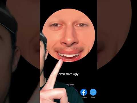 This needs to stop #storytelling #funny #relatable