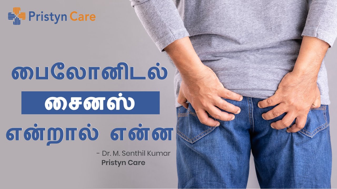 What is Pilonidal Sinus | பைலோனிடல் சைனஸ் என்றால் என்ன | Best Treatment for Pilonidal Sinus