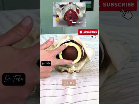 cervical dilation examination #pregnancy #baby #delivery #healthcare