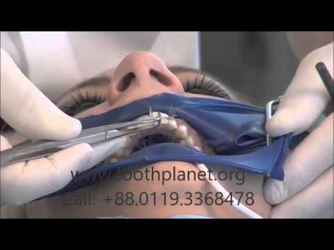 Componeer by Tooth Planet Dhaka, Bangladesh