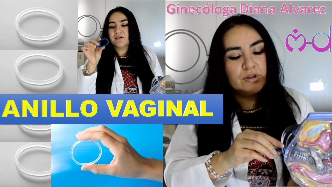 ANILLO VAGINAL POR GINECOLOGA DIANA ALVAREZ