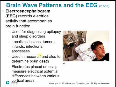 2113 Chapter 12 Central Nervous System Part C