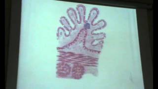 Dr Gihan - Digestive 4 (part2).avi