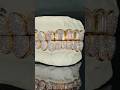 10x10 Flawless Hybrid Baguette Honeycomb Set Diamond Grillz By Johnny Dang Jewelry Grillz