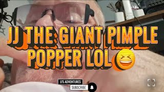 JJ'S PIMPLE #pimple #popping #spots #cyss #pain #funny #like #live #life #lol #magic #memes #wow #ko